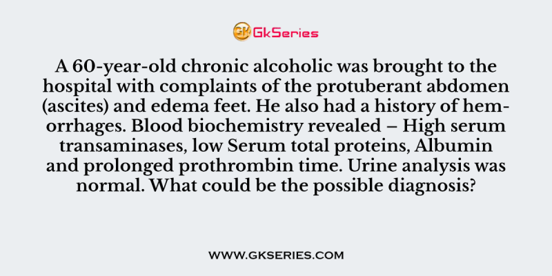 A 60-year-old chronic alcoholic was brought to the hospital with complaints of the protuberant abdomen (ascites) and edema feet