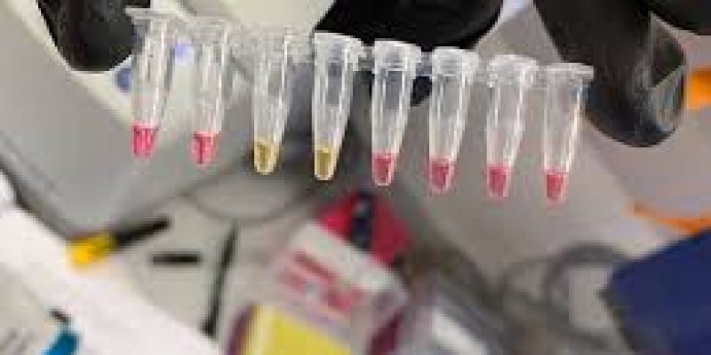 RT-LAMP based test for Coronavirus