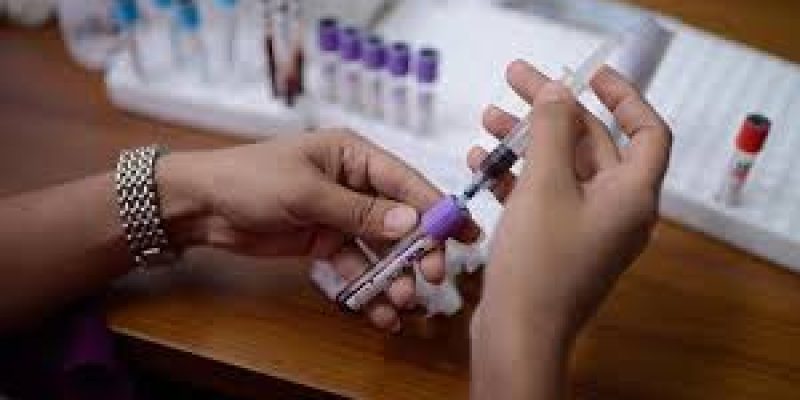 Rapid diagnostic kit for COVID 19 screening