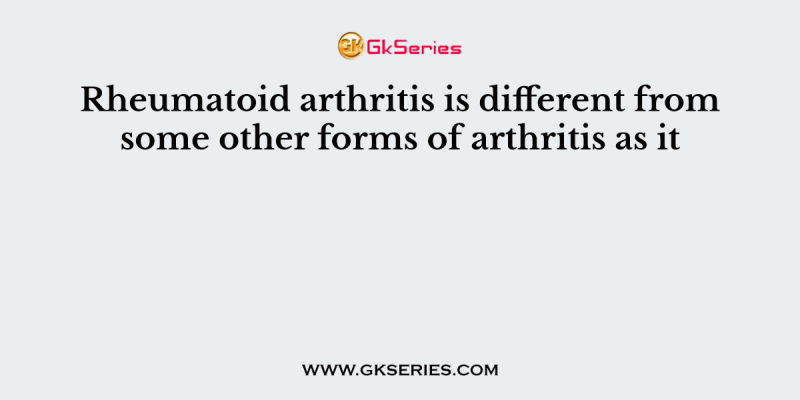 Rheumatoid arthritis is different from some other forms of arthritis as it