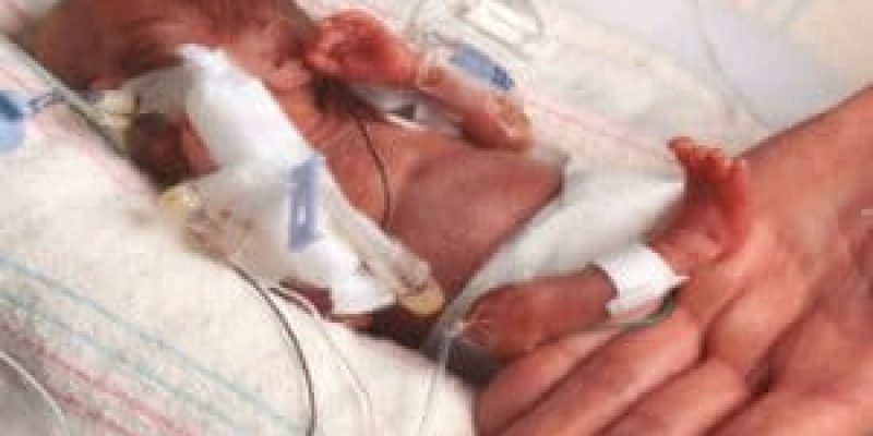 The Worlds smallest baby, weighing 245 grams survives
