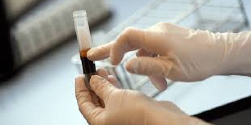 The plasma therapy debate