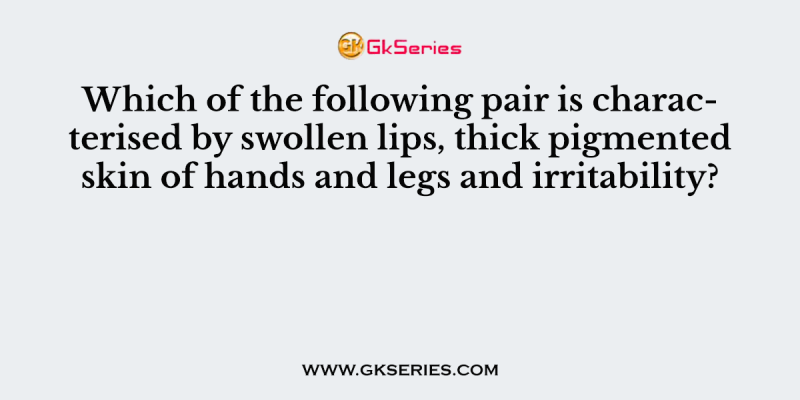 Which of the following pair is characterised by swollen lips, thick pigmented skin of hands and legs and irritability?