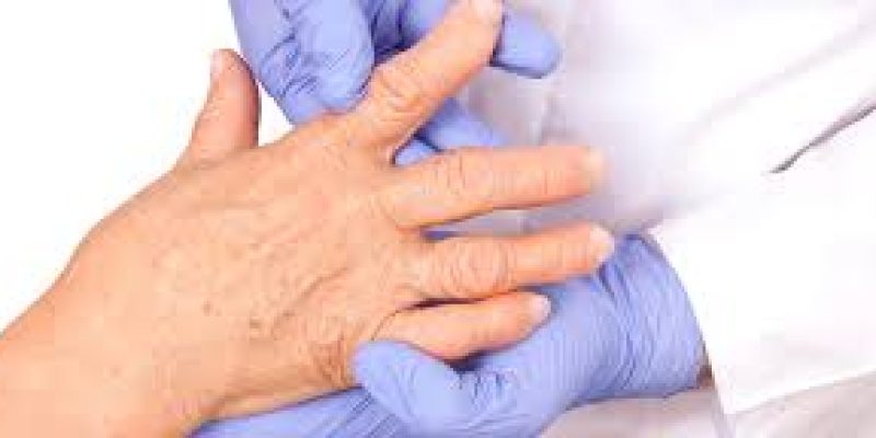 World Arthritis Day 2020