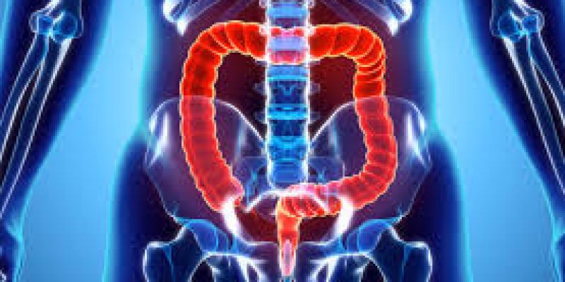 Body fluids can provide clue for early detection of colon cancer