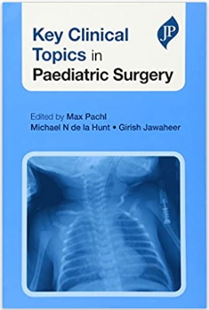 paediatric surgery book